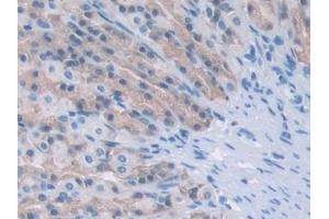 Detection of PPARg in Rat Stomach Tissue using Monoclonal Antibody to Peroxisome Proliferator Activated Receptor Gamma (PPARg) (PPARG 抗体  (AA 311-493))