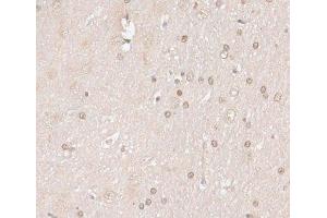 Immunohistochemistry of paraffin-embedded Rat brain using HMGN1 Polyclonal Antibody at dilution of 1:100 (40x lens). (HMGN1 抗体)