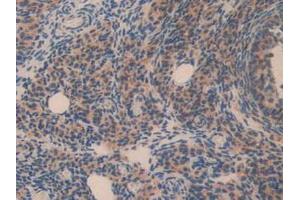 IHC-P analysis of Mouse Ovary Tissue, with DAB staining. (Olfactomedin 4 抗体  (AA 238-500))