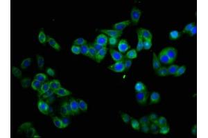 Immunofluorescence staining of PC-3 cells with ABIN7160347 at 1:133, counter-stained with DAPI. (CHRM3 抗体  (AA 253-492))