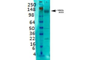 Western Blot analysis of Rat brain membrane lysate showing detection of KCC2 protein using Mouse Anti-KCC2 Monoclonal Antibody, Clone S1-12 . (KCC2 抗体  (AA 932-1043) (APC))
