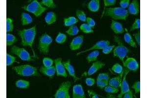 IF analysis of ACADM/MCAD using anti-ACADM/MCAD antibody (ABIN7601543). (Medium-Chain Specific Acyl-CoA Dehydrogenase, Mitochondrial (MCAD) (AA 38-401) 抗体)