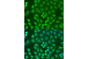 Immunofluorescence analysis of U2OS cells using ZFYVE16 antibody (ABIN6129169, ABIN6150439, ABIN6150441 and ABIN6223717) at dilution of 1:100. (ZFYVE16 抗体  (AA 1-280))