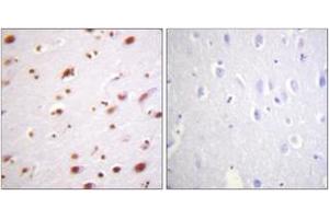 Immunohistochemistry analysis of paraffin-embedded human brain, using Catenin-delta1 (Phospho-Tyr228) Antibody. (CTNND1 抗体  (pTyr228))