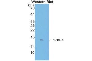 Western blot analysis of the recombinant protein. (GDF3 抗体  (AA 253-366))