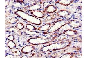 Immunohistochemistry of paraffin-embedded human kidney tissue using ABIN7152982 at dilution of 1:100 (FAK 抗体  (AA 363-464))