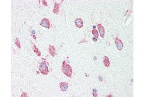 Anti-HEXA antibody IHC staining of human brain, cortex. (Hexosaminidase A 抗体  (AA 142-170))