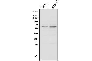 Western blot analysis of NOXA2/p67phox/NCF2 using anti-NOXA2/p67phox/NCF2 antibody (ABIN7599462).