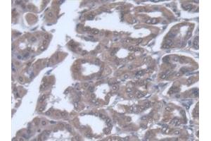Immunohistochemistry (IHC) image for anti-Valyl-tRNA Synthetase (VARS) (AA 186-421) antibody (ABIN7444919)