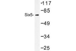 Image no. 1 for anti-Homeobox protein SIX5 (SIX5) antibody (ABIN317916) (Six5 抗体)