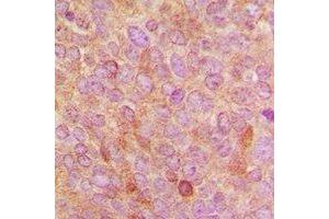 Immunohistochemistry (IHC) image for anti-Cytochrome P450, Family 24, Subfamily A, Polypeptide 1 (CYP24A1) (C-Term) antibody (ABIN7303146)