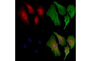 ABIN6258462 and ABIN6273867 staining  cells by IF/ICC. (GPER 抗体  (C-Term))