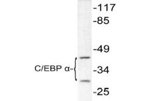 Image no. 1 for anti-CCAAT/enhancer Binding Protein (C/EBP), alpha (CEBPA) antibody (ABIN271872) (CEBPA 抗体)