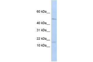 WB Suggested Anti-VPREB1 Antibody Titration:  0. (VPREB1 抗体  (Middle Region))