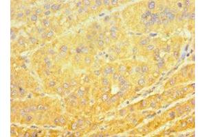 Immunohistochemistry (IHC) image for anti-Cytochrome P450, Family 4, Subfamily A, Polypeptide 11 (CYP4A11) (AA 1-200) antibody (ABIN7149270)