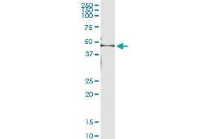 Immunoprecipitation of KRT35 transfected lysate using anti-KRT35 MaxPab rabbit polyclonal antibody and Protein A Magnetic Bead , and immunoblotted with KRTHA5 MaxPab mouse polyclonal antibody (B01) . (Keratin 35 抗体  (AA 1-455))