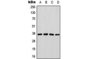 Western blot analysis of Cathepsin H expression in Jurkat (A), K562 (B), mouse kidney (C), PC12 (D) whole cell lysates.