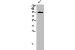 Western Blot analysis of 823 cells using Phospho-PKC ζ (T410) Polyclonal Antibody (PKC zeta 抗体  (pThr410))