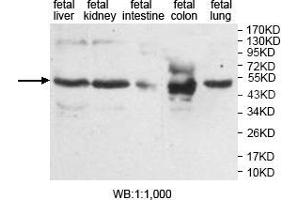 Western blot analysis of various fetal tissue, using AMN antibody. (AMN 抗体  (Middle Region))