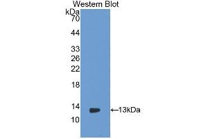 Western blot analysis of the recombinant protein. (PIGR 抗体  (AA 343-447))
