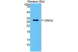 Detection of Recombinant CA2, Gallus using Polyclonal Antibody to Carbonic Anhydrase II (CA2) (CA2 抗体  (AA 1-260))