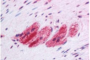 Human Colon, Myenteric Plexus: Formalin-Fixed, Paraffin-Embedded (FFPE) (SEPN1 抗体  (C-Term))