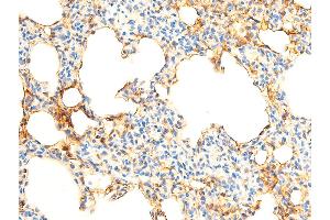 Immunohistochemistry (IHC) image for anti-Nuclear Factor of kappa Light Polypeptide Gene Enhancer in B-Cells Inhibitor, alpha (NFKBIA) (pSer32), (pSer36) antibody (ABIN6256292)
