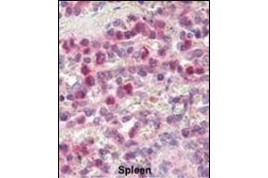 Immunohistochemistry (Paraffin-embedded Sections) (IHC (p)) image for anti-Matrix Metallopeptidase 9 (Gelatinase B, 92kDa Gelatinase, 92kDa Type IV Collagenase) (MMP9) (AA 644-673), (C-Term) antibody (ABIN390154)