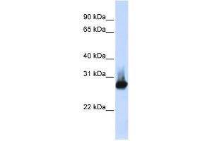 BCAP31 antibody used at 1 ug/ml to detect target protein. (BCAP31 抗体  (Middle Region))