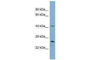 MRPS2 antibody used at 1 ug/ml to detect target protein. (MRPS2 抗体  (N-Term))