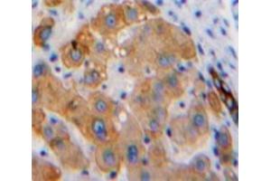 #VALUE! (Hexosaminidase A 抗体  (AA 319-528))