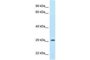 PPP1R3B 抗体  (AA 40-89)