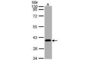 WB Image Sample (30 ug of whole cell lysate) A: A431 10% SDS PAGE antibody diluted at 1:1000 (SUCLG1 抗体)