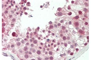 Rabbit Anti-RARG antibody  Formalin Fixed Paraffin Embedded Tissue: Human Testis Primary antibody Concentration: 1:66. (Retinoic Acid Receptor gamma 抗体  (Middle Region))