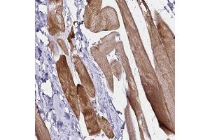 Immunohistochemical staining of human skeletal muscle with HAPLN2 polyclonal antibody ( Cat # PAB28323 ) shows strong cytoplasmic positivity in myocytes. (HAPLN2 抗体)