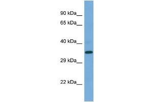 Western Blotting (WB) image for anti-Presenilin 2 (Alzheimer Disease 4) (PSEN2) (C-Term) antibody (ABIN2787885) (Presenilin 2 抗体  (C-Term))