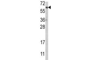Western blot analysis of anti-AKT antibody and MCF-7 lysate.