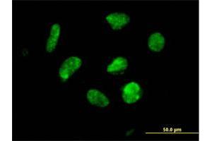 Immunofluorescence of purified MaxPab antibody to ZNF302 on HeLa cell. (ZNF302 抗体  (AA 1-399))