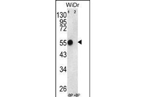 Western blot analysis of ATP5B Antibody (Center) Pab (ABIN650786 and ABIN2839558) pre-incubated without(lane 1) and with(lane 2) blocking peptide in WiDr cell line lysate.