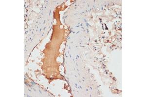 Immunohistochemistry of paraffin-embedded human lung using  antibody (ABIN6127360, ABIN6137012, ABIN6137013 and ABIN6221266) at dilution of 1:100 (40x lens). (APOC1 抗体  (AA 1-83))