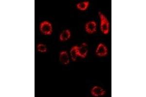 Immunofluorescent analysis of NDRG1 staining in SW480 cells. (NDRG1 抗体)