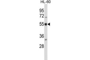 Western Blotting (WB) image for anti-BAI1-Associated Protein 2-Like 2 (BAIAP2L2) antibody (ABIN2997368) (BAIAP2L2 抗体)