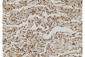 ABIN6272437 at 1/100 staining Human lung tissue by IHC-P. (ZNF280A 抗体  (C-Term))