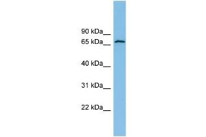 WB Suggested Anti-GLUD2 Antibody Titration: 0. (GLUD2 抗体  (N-Term))
