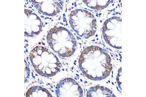 Immunohistochemistry of paraffin-embedded human colon using WISP2 Rabbit pAb (ABIN6128929, ABIN6150227, ABIN6150229 and ABIN6223338) at dilution of 1:100 (40x lens). (WISP2 抗体  (AA 1-250))
