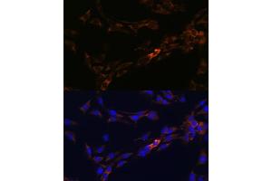 Immunofluorescence (IF) image for anti-Interleukin 13 Receptor, alpha 2 (IL13RA2) antibody (ABIN7267987)