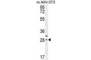 Western Blotting (WB) image for anti-Claudin 22 (CLDN22) antibody (ABIN2995576) (Claudin 22 (CLDN22) 抗体)