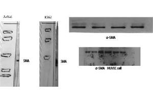 Western Blot (WB) analysis of specific cells using alpha-SMA Polyclonal Antibody. (alpha-SMA (N-Term) 抗体)