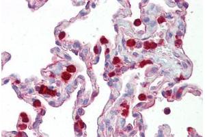Anti-KAL1 / Anosmin antibody IHC staining of human lung. (Anosmin 抗体  (Internal Region))