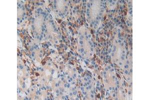 Used in DAB staining on fromalin fixed paraffin- embedded Kidney tissue (MGA 抗体  (AA 2450-2733))